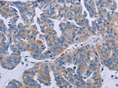 P2RY2 antibody