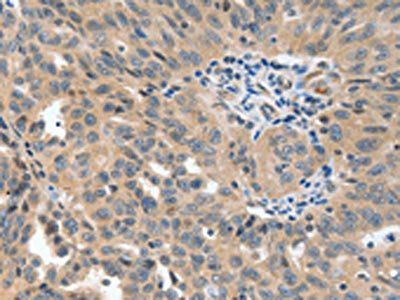 P2RY6 Antibody
