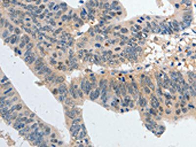 P2RY6 Antibody