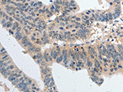 P2RY6 antibody