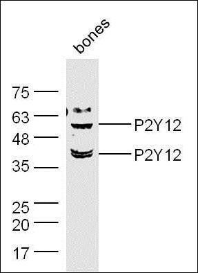P2Y12 Rabbit Polyclonal Antibody