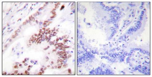 p300 Antibody