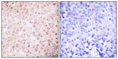 CREBBP antibody