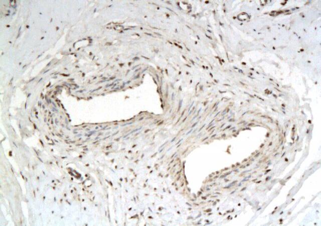 P311 Rabbit Polyclonal Antibody