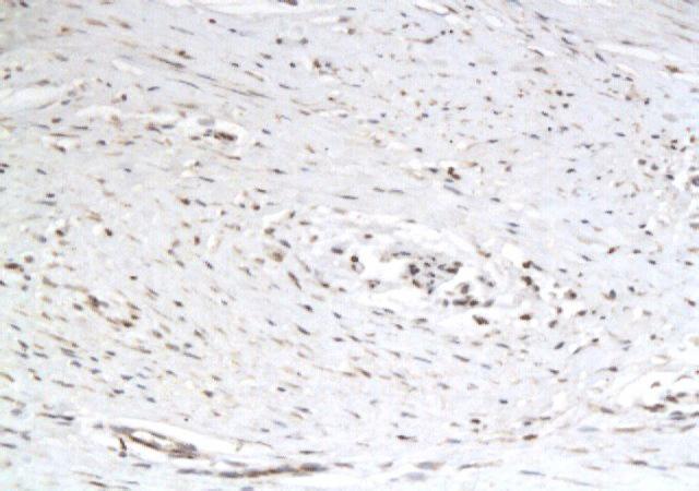 P311 Rabbit Polyclonal Antibody