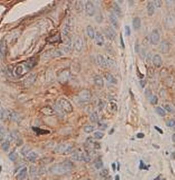 P311 Rabbit Polyclonal Antibody