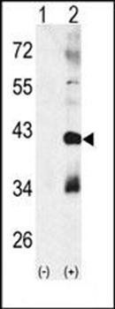 p38 beta antibody
