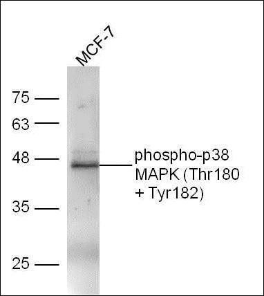 p38 MAPK (phospho-Thr180/Tyr182) antibody