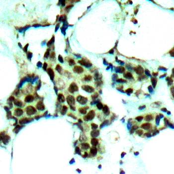 P38 MAPK (Phospho-Tyr182) Antibody