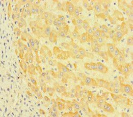 P3H2 Antibody