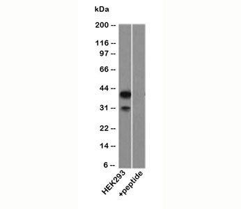 p40 / p63 delta Antibody