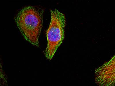 p44/42 MAP Kinase (Phospho-Thr202) Antibody