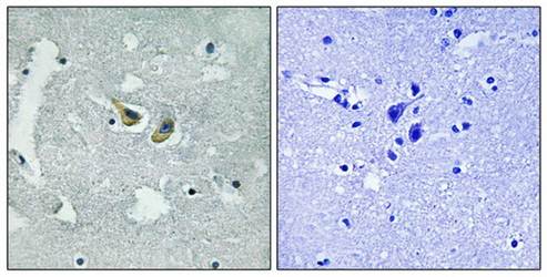 p47 phox (Phospho-Ser345) Antibody