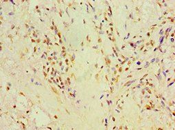 P4HA2 Antibody
