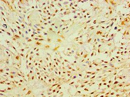P4HA2 Antibody