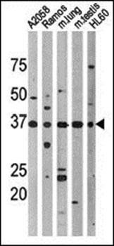 p53 (phospho-Thr18) antibody
