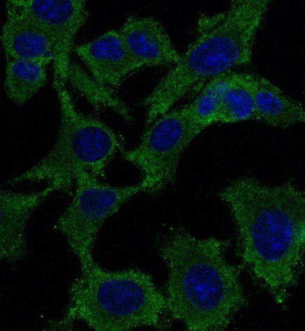 P53 Antibody