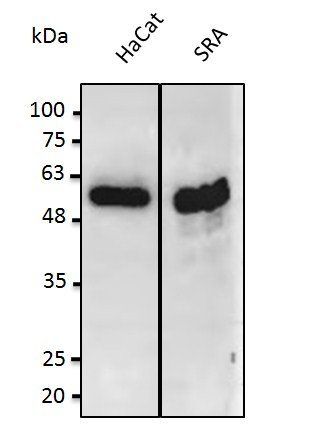P53 Antibody