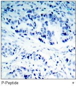 p53 (Phospho-Ser15) Antibody