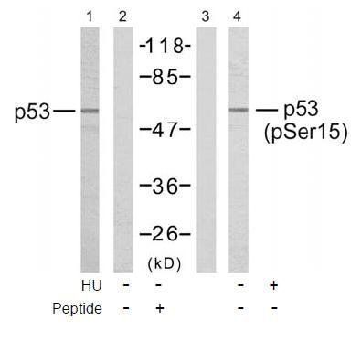 p53 (Phospho-Ser15) Antibody