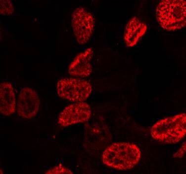 p53 (Phospho-Ser15) Antibody