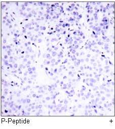 p53 (Phospho-Ser315) Antibody