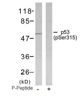 p53 (Phospho-Ser315) Antibody