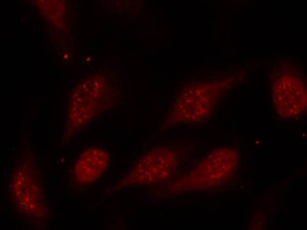 p53 (Phospho-Ser315) Antibody