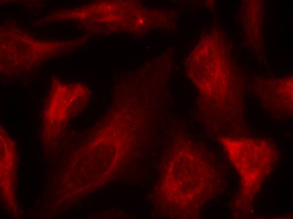 p53 (Phospho-Ser33) Antibody