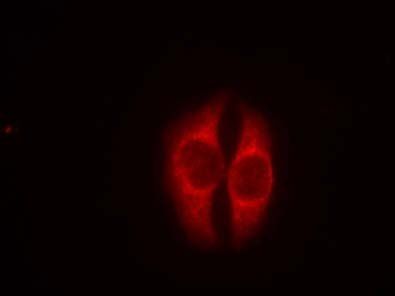 p53 (Phospho-Ser37) Antibody