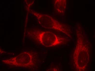 p53 (Phospho-Ser46) Antibody