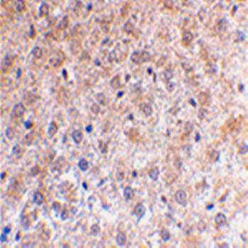p53DINP1 Antibody