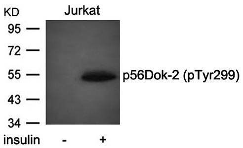 p56Dok-2 (Phospho-Tyr299) Antibody