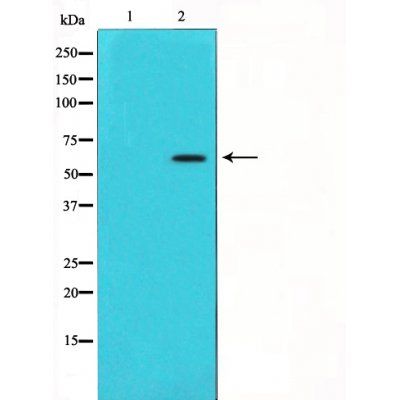 SQSTM1/p62 Antibody