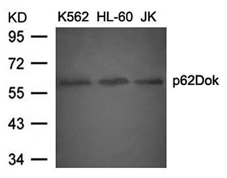 p62Dok (Ab-398) Antibody