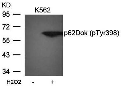 p62Dok (phospho-Tyr398) Antibody