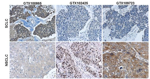 p63 antibody [N2C1], Internal