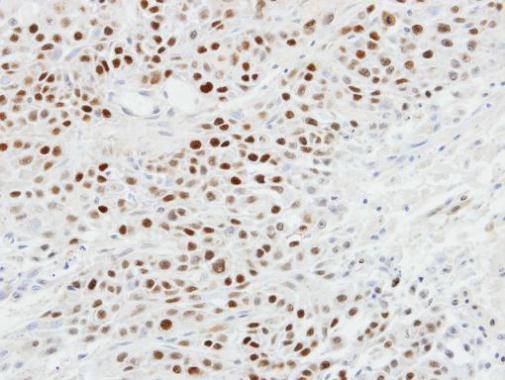 p63 antibody [N2C1], Internal