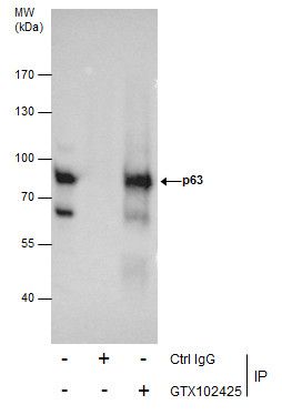 p63 antibody [N2C1], Internal