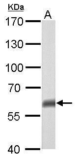p63 antibody [N2C1], Internal