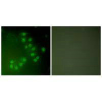 TP63 Antibody