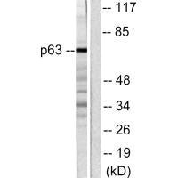TP63 Antibody