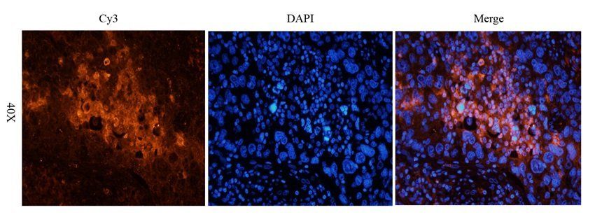 p63 antibody