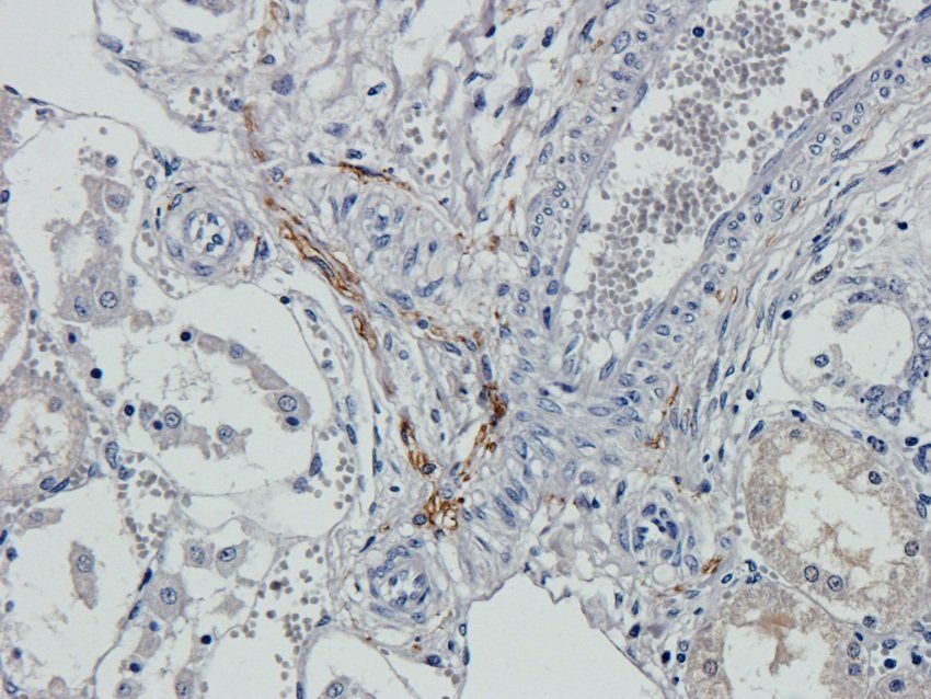 p63 antibody