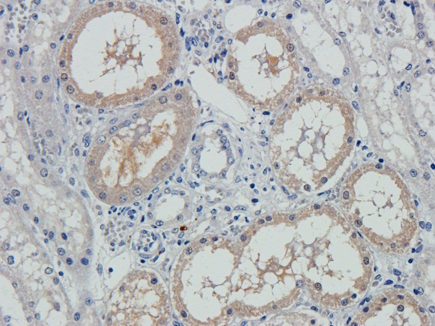 p63 antibody