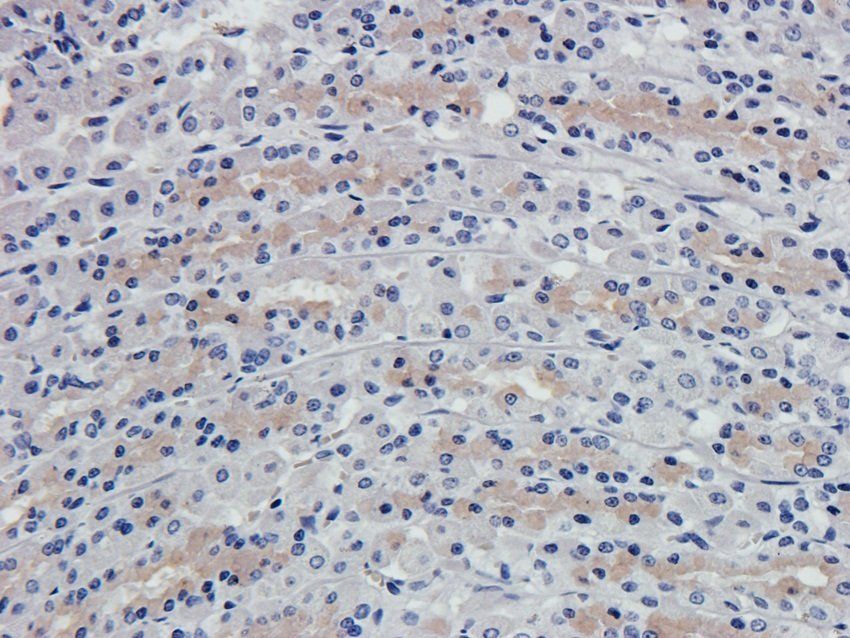 p63 antibody