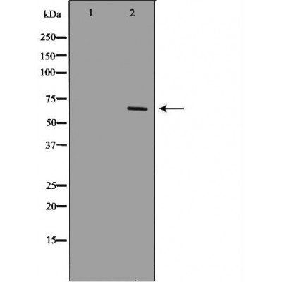 NF-kB p65 Antibody