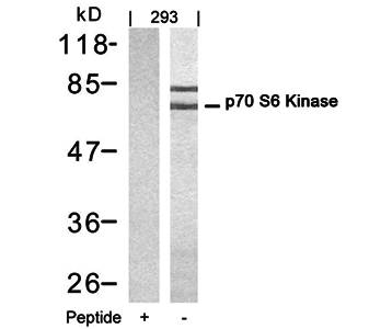 p70 S6 Kinase (Ab-421) Antibody [Out of stock]