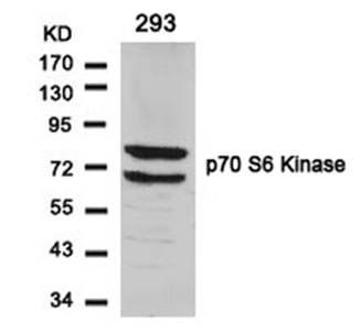 p70 S6 Kinase Rabbit Polyclonal Antibody