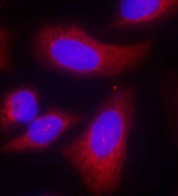 p70 S6 Kinase (Ab-424) Antibody